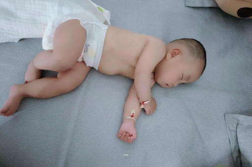 丽江宝宝脸上有白色斑块